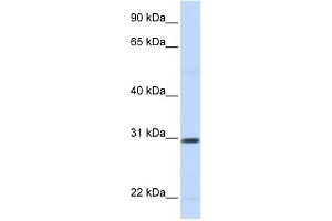 WB Suggested Anti-STC1 Antibody Titration:  0. (Stanniocalcin 1 抗体  (N-Term))