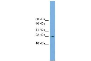 Human COLO205; WB Suggested Anti-PPIL3 Antibody Titration: 0. (PPIL3 抗体  (Middle Region))