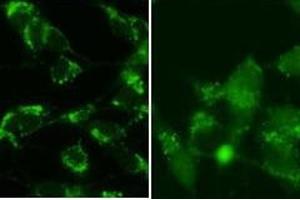 SY5Y cells were pretreated with 5nM bafilomycin for 24hr and fixed in methanol (left panel) or 4 % of paraformaldehyde (right panel). (LC3B 抗体  (cleaved))