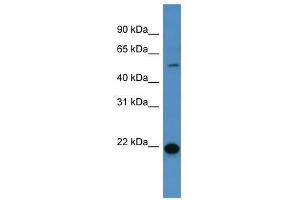 Western Blot showing CEACAM3 antibody used at a concentration of 1-2 ug/ml to detect its target protein. (CEACAM3 抗体  (C-Term))