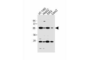 All lanes : Anti-SLC10A1 Antibody (C-term) at 1:1000 dilution Lane 1: HT-1080 whole cell lysate Lane 2: HepG2 whole cell lysate Lane 3: K562 whole cell lysate Lane 4: Caco2 whole cell lysate Lysates/proteins at 20 μg per lane.
