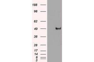 Image no. 16 for anti-Myc Proto-Oncogene protein (MYC) antibody (ABIN1497011) (c-MYC 抗体)