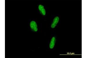 Immunofluorescence of purified MaxPab antibody to SP110 on HepG2 cell. (SP110 抗体  (AA 1-547))