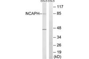 Western blot analysis of extracts from COLO cells, using NCAPH Antibody. (NCAPH 抗体  (AA 441-490))