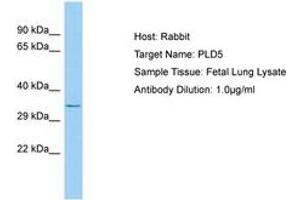Image no. 1 for anti-Phospholipase D Family, Member 5 (PLD5) (AA 189-238) antibody (ABIN6750223) (PLD5 抗体  (AA 189-238))