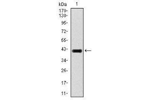 Image no. 4 for anti-E2F Transcription Factor 1 (E2F1) antibody (ABIN1491636) (E2F1 抗体)