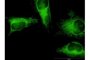 Immunofluorescence of monoclonal antibody to GSDMB on HeLa cell. (Gasdermin B 抗体  (AA 1-411))