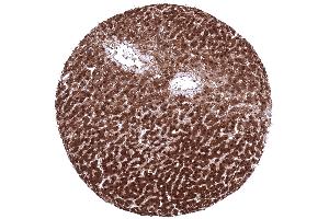 Strong nuclear and cytoplasmic arginase 1 expression in all hepatocytes in a normal liver (Recombinant Liver Arginase 抗体  (AA 300-400))