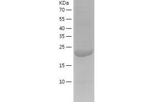 Western Blotting (WB) image for Glutathione S-Transferase pi 1 (GSTP1) (AA 2-210) protein (His-IF2DI Tag) (ABIN7123150)