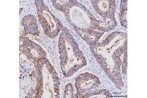 IHC analysis of Claudin 3/CLDN3 using anti-Claudin 3/CLDN3 antibody (ABIN7599625).