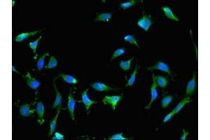 Immunofluorescent analysis of Hela cells using ABIN7167262 at dilution of 1:100 and Alexa Fluor 488-congugated AffiniPure Goat Anti-Rabbit IgG(H+L) (RAB25 抗体  (AA 1-210))