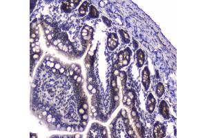 Immunohistochemistry (IHC) image for anti-Poly A Specific Ribonuclease (PARN) (AA 1-301) antibody (ABIN5693032)