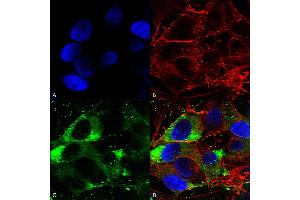 Immunocytochemistry/Immunofluorescence analysis using Mouse Anti-Nav1.