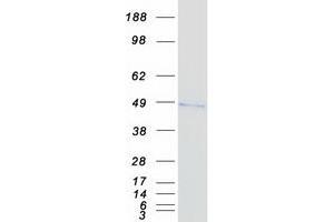 Western Blotting (WB) image for Dual Specificity Phosphatase 4 (DUSP4) (Transcript Variant 1) protein (Myc-DYKDDDDK Tag) (ABIN2719837)