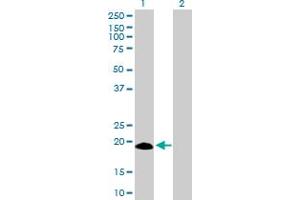 Western Blot analysis of IFNA17 expression in transfected 293T cell line by IFNA17 MaxPab polyclonal antibody. (IFNA17 抗体  (AA 1-189))