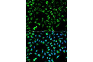 Immunofluorescence analysis of A549 cell using NME1 antibody. (NME1 抗体  (C-Term))