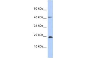 Western Blotting (WB) image for anti-SFRS12-Interacting Protein 1 (SFRS12IP1) antibody (ABIN2463941) (SFRS12IP1 抗体)