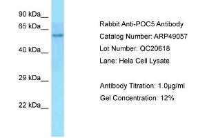 Western Blotting (WB) image for anti-POC5 Centriolar Protein Homolog (POC5) (C-Term) antibody (ABIN2783623) (POC5 抗体  (C-Term))