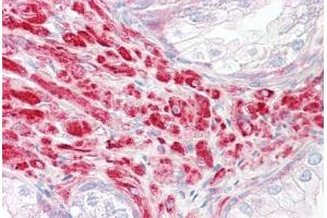 Image no. 2 for anti-Dickkopf 2 Homolog (DKK2) (AA 124-173) antibody (ABIN6749760) (DKK2 抗体  (AA 124-173))