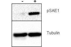 Western blot using  Rabbit anti-SAE1 pS185 antibody shows detection of phosphorylated SAE1. (SAE1 抗体  (pSer185))