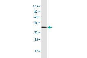 Western Blotting (WB) image for anti-Dicer 1, Ribonuclease Type III (DICER1) (AA 1813-1912) antibody (ABIN525146)