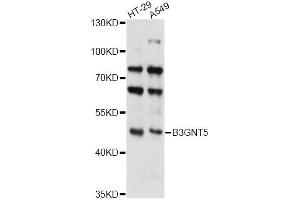 Western blot analysis of extracts of various cell lines, using B3GNT5 antibody (ABIN6293241) at 1:3000 dilution. (B3GNT5 抗体)