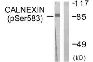 Western blot analysis of extracts from HeLa cells treated with EGF 200ng/ml 30', using Calnexin (Phospho-Ser583) Antibody. (Calnexin 抗体  (pSer583))
