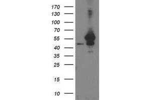 Western Blotting (WB) image for anti-ADP-Ribosylation Factor GTPase Activating Protein 1 (ARFGAP1) antibody (ABIN1496682) (ARFGAP1 抗体)