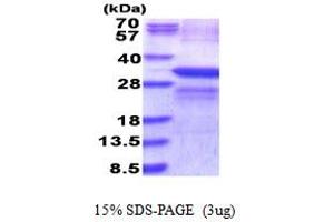 SDS-PAGE (SDS) image for Lysyl Oxidase (LOX) (AA 169-417) protein (His tag) (ABIN5853903) (LOX Protein (AA 169-417) (His tag))