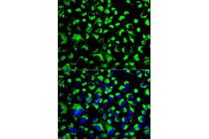 Immunofluorescence analysis of U2OS cell using HSPA9 antibody. (HSPA9 抗体  (AA 380-679))