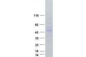 Western Blotting (WB) image for Tripartite Motif Containing 13 (TRIM13) (Transcript Variant 3) protein (Myc-DYKDDDDK Tag) (ABIN2734224)