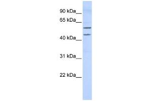 WB Suggested Anti-TBX22 Antibody Titration:  0. (T-Box 22 抗体  (Middle Region))