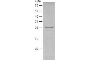 Western Blotting (WB) image for Dickkopf Homolog 1 (DKK1) (AA 1-272) protein (His tag) (ABIN7122660)