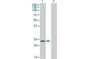 Western Blot analysis of RCV1 expression in transfected 293T cell line by RCV1 monoclonal antibody (M11), clone 2B3. (Recoverin 抗体  (AA 101-199))
