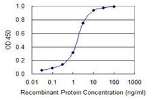 Detection limit for recombinant GST tagged LMTK3 is 0. (LMTK3 抗体  (AA 1151-1250))