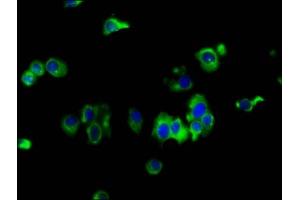 Immunofluorescence staining of MCF-7 cells with ABIN7151929 at 1:133, counter-stained with DAPI. (EMP2 抗体  (AA 22-66))