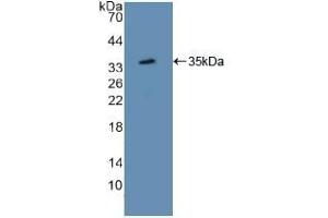Detection of Recombinant ATF1, Mouse using Polyclonal Antibody to Activating Transcription Factor 1 (ATF1) (AFT1 抗体  (AA 3-245))