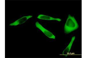 Immunofluorescence of purified MaxPab antibody to RARS on HeLa cell. (RARS 抗体  (AA 1-660))