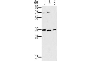 Western Blotting (WB) image for anti-Interleukin 22 Receptor, alpha 2 (IL22RA2) antibody (ABIN2430301) (IL22RA2 抗体)
