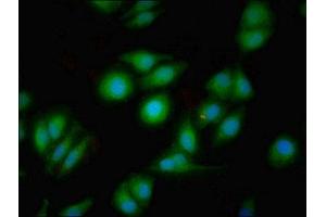 Immunofluorescent analysis of A549 cells using ABIN7149466 at dilution of 1:100 and Alexa Fluor 488-congugated AffiniPure Goat Anti-Rabbit IgG(H+L) (Dopamine Receptor d1 抗体  (AA 338-446))