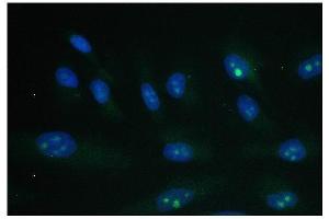 IF analysis of PARN using anti-PARN antibody (ABIN6719422). (PARN 抗体  (AA 1-301))