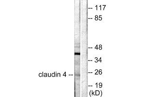 Western blot analysis of extracts from HeLa cells, using Claudin 4 antibody (ABIN5976355). (Claudin 4 抗体  (C-Term))