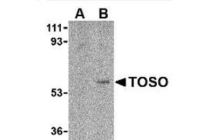 Image no. 1 for anti-Fas Apoptotic Inhibitory Molecule 3 (FAIM3) (C-Term) antibody (ABIN318759) (FAIM3 抗体  (C-Term))