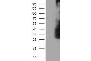 Western Blotting (WB) image for anti-Low Density Lipoprotein Receptor Adaptor Protein 1 (LDLRAP1) antibody (ABIN1496692) (LDLRAP1 抗体)