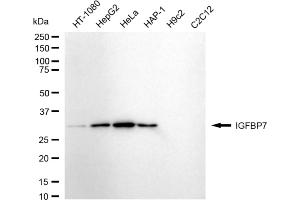 Western blotting analysis using IGFBP7 antibody (ABIN7799057). (Recombinant IGFBP7 抗体)