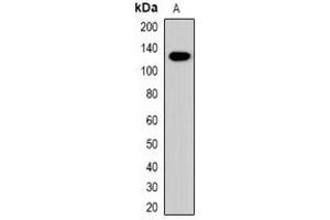 Western blot analysis of Collagen 4 alpha 1 expression in mouse brain (A) whole cell lysates. (COL4A1 抗体  (C-Term))