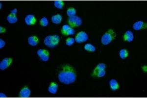 IF analysis of TIMM29 using anti-TIMM29 antibody (ABIN7601495). (TIMM29 抗体  (AA 37-260))