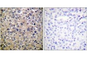 Immunohistochemistry (IHC) image for anti-Protein Phosphatase 1, Catalytic Subunit, alpha Isoform (PPP1CA) (AA 281-330) antibody (ABIN1532484)