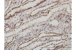 Immunoperoxidase of monoclonal antibody to TSG101 on formalin-fixed paraffin-embedded human kidney. (TSG101 抗体  (AA 201-280))
