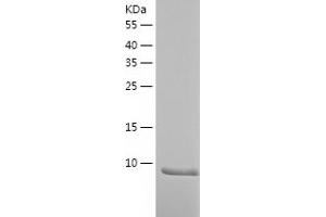 Western Blotting (WB) image for Interleukin 5 (IL5) (AA 21-133) protein (His tag) (ABIN7123602) (IL-5 Protein (AA 21-133) (His tag))